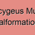 Coccygeus Muscle Diseases