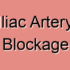 Common Iliac Artery Partial Blockage