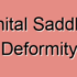 Acquired Saddle Nose Deformity