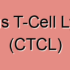 Primary Cutaneous Anaplastic Large Cell Lymphoma (pcALCL)