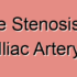 Cardiogenic Common Iliac Artery