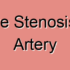 Arteriosclerotic Stenosis of Femoral Artery