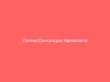 Dermal Dendrocyte Hamartoma