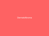 Dermatofibroma