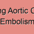 Descending Aortic Thrombotic Embolism