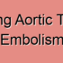 Descending Aortic Cholesterol Embolism
