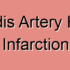 Dorsalis Pedis Artery Infarction