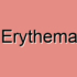 Erythema Multiforme