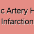 External Iliac Artery Dissection