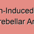 Non-Aneurysmal Posterior Inferior Cerebellar Artery Stroke