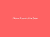 Fibrous Papule of the Face