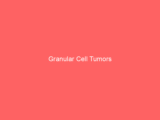 Granular Cell Tumors