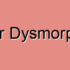 Skin Dysmorphia