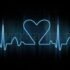 Bradycardia; Causes, Symptoms, Diagnosis, Treatment