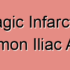 Common Iliac Artery Dissection