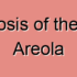 Hyperkeratotic Actinic Keratosis