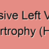 Diastolic Heart Failure