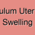 Infundibulum Uterine Tube Atrophy