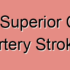 Hemorrhagic Superior Cerebellar Artery Stroke