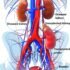 Dialysis – Indications, Contraindications
