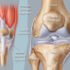 Contraindications and Complication of Knee Arthroplasty