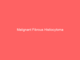 Malignant Fibrous Histiocytoma