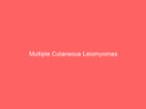 Multiple Cutaneous Leiomyomas