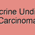 Pleomorphic Undifferentiated Carcinoma