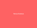Nevus Araneus