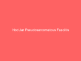 Nodular Pseudosarcomatous Fasciitis