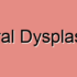 Bronchopulmonary Dysplasia