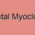 Startle Myoclonus