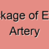 Complete Blockage of External Iliac Artery