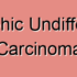 Sarcomatoid Carcinoma