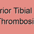 Posterior Tibial Artery Thrombotic Embolism