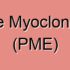 Startle Myoclonus
