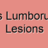 Quadratus Lumborum Muscle Degeneration