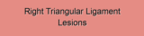 Right Triangular Ligament Lesions