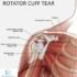 Nerves Supply of Rotator Cuff Muscle