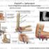 Elbow Joints Fractures – Causes, Symptoms, Treatment