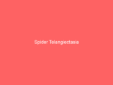 Spider Telangiectasia