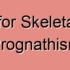 What is Skeletal Mandibular Prognathism?