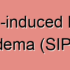 Surfactant Metabolism Dysfunction
