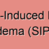 Diving-Induced Pulmonary Edema