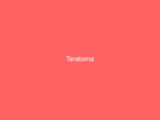 Teratoma