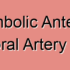 Cardiogenic Anterior Inferior Temporal Artery Stroke