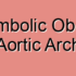 Aneurysmal Obstruction of the Aortic Arch