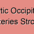 Embolic Occipitoparietal Arteries Stroke