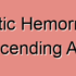 Descending Aorta Infarction