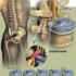 C3 and C4 Disc Herniation – Causes, Symptoms, Treatment